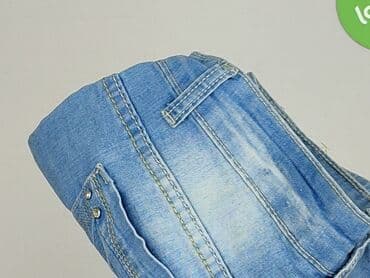 krótkie spodenki i nogi z cellulitem: Szorty damskie, XS — 6