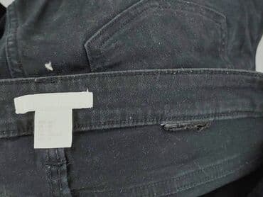 krótkie spodenki i nogi z cellulitem: H&M, Szorty damskie, rozmiar M — 4