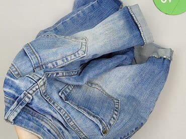 krótkie spodenki i nogi z cellulitem: Amisu, Szorty damskie, XS — 5